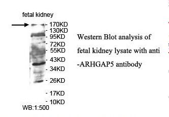 ARHGAP5 / RhoGAP5 Antibody
