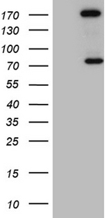ARHGAP5 / RhoGAP5 Antibody - HEK293T cells were transfected with the pCMV6-ENTRY control. (Left lane) or pCMV6-ENTRY ARHGAP5. (Right lane) cDNA for 48 hrs and lysed. Equivalent amounts of cell lysates. (5 ug per lane) were separated by SDS-PAGE and immunoblotted with anti-ARHGAP5. (1:2000)