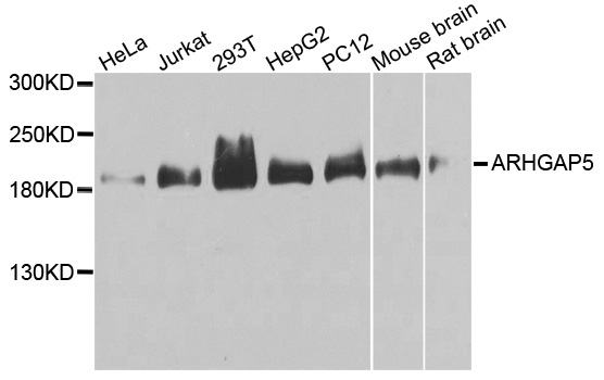 ARHGAP5 / RhoGAP5 Antibody - Western blot analysis of extracts of various cells.