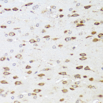 ARHGAP5 / RhoGAP5 Antibody - Immunohistochemistry of paraffin-embedded rat brain tissue.