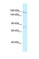 ARHGAP5 / RhoGAP5 Antibody - ARHGAP5 antibody Western blot of Mouse Thymus lysate. Antibody concentration 1 ug/ml.  This image was taken for the unconjugated form of this product. Other forms have not been tested.