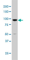 ARHGAP6 Antibody - ARHGAP6 monoclonal antibody (M01), clone 6B3 Western Blot analysis of ARHGAP6 expression in K-562.