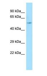 ARHGAP8 Antibody - ARHGAP8 antibody Western Blot of 293T.  This image was taken for the unconjugated form of this product. Other forms have not been tested.