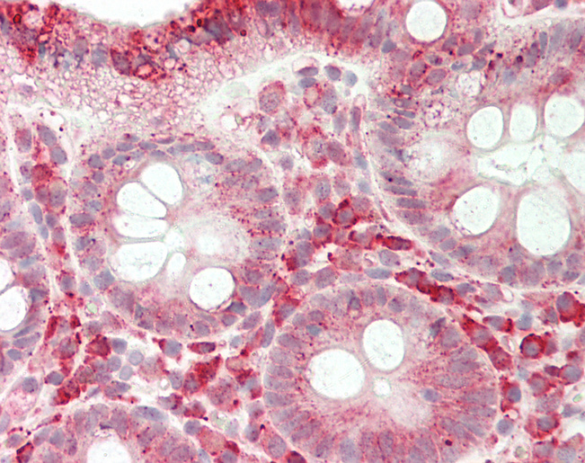 ARHGAP8 Antibody - Human Colon: Formalin-Fixed, Paraffin-Embedded (FFPE).  This image was taken for the unconjugated form of this product. Other forms have not been tested.