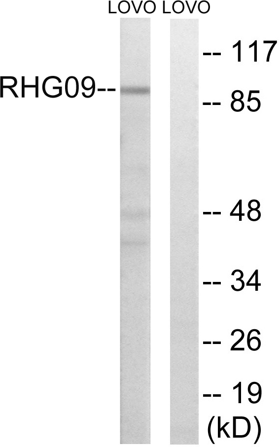 ARHGAP9 Antibody - Western blot analysis of lysates from LOVO cells, using RHG9 Antibody. The lane on the right is blocked with the synthesized peptide.