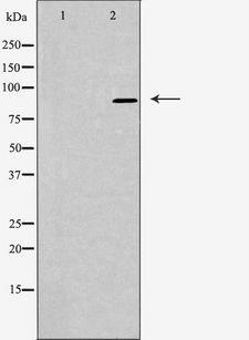 ARHGAP9 Antibody - Western blot analysis of extracts of LOVO cells using RHG9 antibody. The lane on the left is treated with the antigen-specific peptide.