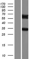 ARHGAP9 Protein - Western validation with an anti-DDK antibody * L: Control HEK293 lysate R: Over-expression lysate