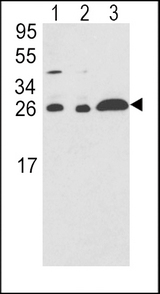 ARHGDIA / RHOGDI Antibody - Western blot of ARHGDIA Antibody in A375(lane 1),HL-60(lane 2),Ramos(lane 3) cell line lysates (35 ug/lane). ARHGDIA (arrow) was detected using the purified antibody.