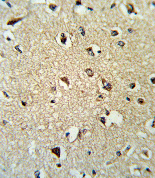 ARHGDIA / RHOGDI Antibody - Formalin-fixed and paraffin-embedded human brain tissue reacted with ARHGDIA Antibody , which was peroxidase-conjugated to the secondary antibody, followed by DAB staining. This data demonstrates the use of this antibody for immunohistochemistry; clinical relevance has not been evaluated.