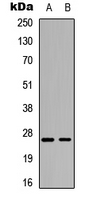 ARHGDIA / RHOGDI Antibody - Western blot analysis of RhoGDI alpha (pS174) expression in HeLa (A); Jurkat (B) whole cell lysates.