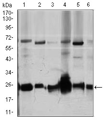 ARHGDIA / RHOGDI Antibody - Western blot using ARHGDIA mouse monoclonal antibody against Jurkat (1), HeLa (2), NIH3T3 (3), C6 (4), K562 (5), and COS7 (6) cell lysate.