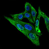 ARHGDIA / RHOGDI Antibody - Immunofluorescence of HepG2 cells using ARHGDIA mouse monoclonal antibody (green). Blue: DRAQ5 fluorescent DNA dye.