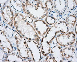 ARHGDIA / RHOGDI Antibody - IHC of paraffin-embedded Kidney tissue using anti-ARHGDIA mouse monoclonal antibody. (Dilution 1:50).