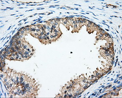 ARHGDIA / RHOGDI Antibody - IHC of paraffin-embedded prostate tissue using anti-ARHGDIA mouse monoclonal antibody. (Dilution 1:50).