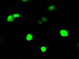 ARHGDIA / RHOGDI Antibody - Anti-ARHGDIA mouse monoclonal antibody  immunofluorescent staining of COS7 cells transiently transfected by pCMV6-ENTRY ARHGDIA.