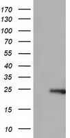 ARHGDIA / RHOGDI Antibody - HEK293T cells were transfected with the pCMV6-ENTRY control (Left lane) or pCMV6-ENTRY ARHGDIA (Right lane) cDNA for 48 hrs and lysed. Equivalent amounts of cell lysates (5 ug per lane) were separated by SDS-PAGE and immunoblotted with anti-ARHGDIA.