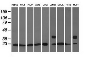 ARHGDIA / RHOGDI Antibody - Western blot analysis of extracts (35ug) from 9 different cell lines by using anti-ARHGDIA monoclonal antibody.