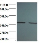 ARHGDIA / RHOGDI Antibody - Western blot of Rho GDP-dissociation inhibitor 1 antibody at 2 ug/ml. Lane 1: EC109 whole cell lysate. Lane 2: 293T whole cell lysate. Secondary: Goat polyclonal to Rabbit IgG at 1:15000 dilution. Predicted band size: 22.4 kDa. Observed band size: 40 kDa.  This image was taken for the unconjugated form of this product. Other forms have not been tested.