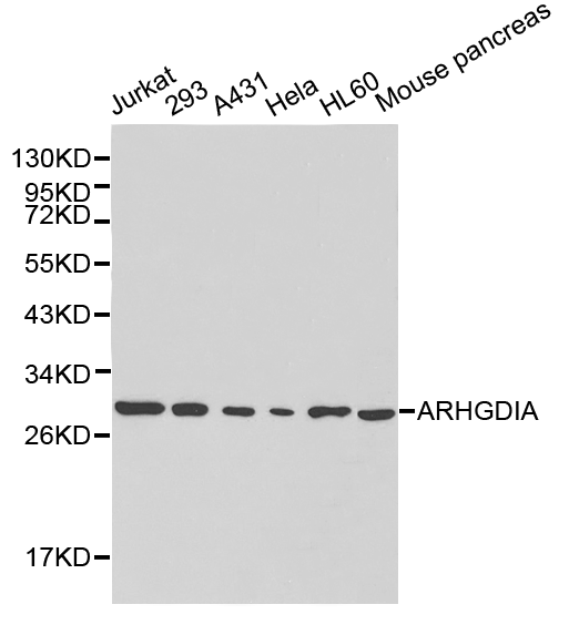 ARHGDIA / RHOGDI Antibody - Western blot of ARHGDIA pAb in extracts from Jurkat, 293T, A431, Hela, HL60 cells and mouse pancreas tissue.