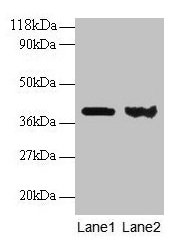 ARHGDIA / RHOGDI Antibody - Western blot All lanes: Rho GDP-dissociation inhibitor 1 antibody at 2µg/ml Lane 1: EC109 whole cell lysate Lane 2: 293T whole cell lysate Secondary Goat polyclonal to rabbit IgG at 1/15000 dilution Predicted band size: 24, 19 kDa Observed band size: 40 kDa