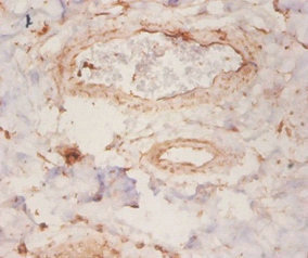 ARHGDIA / RHOGDI Antibody - Immunohistochemistry of paraffin-embedded human mammary gland tissue using ARHGDIA Antibody at dilution of 1:50