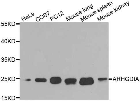 ARHGDIA / RHOGDI Antibody - Western blot analysis of extracts of various cell lines, using ARHGDIA antibody at 1:1000 dilution. The secondary antibody used was an HRP Goat Anti-Rabbit IgG (H+L) at 1:10000 dilution. Lysates were loaded 25ug per lane and 3% nonfat dry milk in TBST was used for blocking.