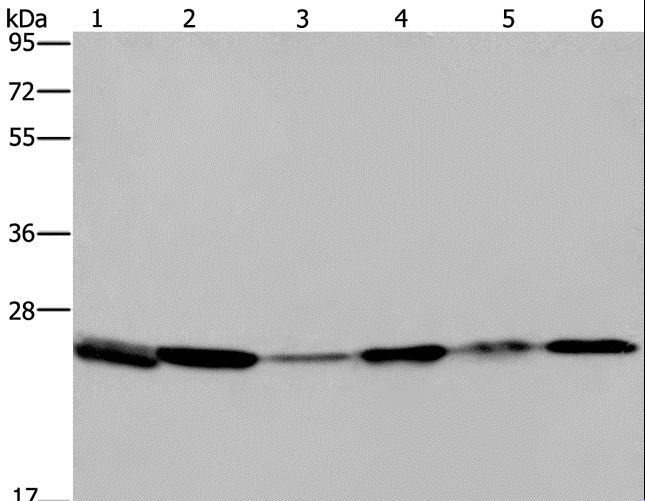 ARHGDIA / RHOGDI Antibody - Western blot analysis of Mouse spleen tissue, A375, A549 and HT-29 cell, mouse lung and HeLa cell, using ARHGDIA Polyclonal Antibody at dilution of 1:400.
