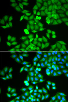 ARHGDIA / RHOGDI Antibody - Immunofluorescence analysis of HeLa cells using ARHGDIA antibody. Blue: DAPI for nuclear staining.