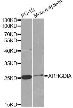 ARHGDIA / RHOGDI Antibody - Western blot analysis of extracts of various cell lines, using ARHGDIA antibody at 1:1000 dilution. The secondary antibody used was an HRP Goat Anti-Rabbit IgG (H+L) at 1:10000 dilution. Lysates were loaded 25ug per lane and 3% nonfat dry milk in TBST was used for blocking. An ECL Kit was used for detection and the exposure time was 3s.