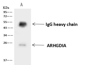 ARHGDIA / RHOGDI Antibody - ARHGDIA was immunoprecipitated using: Lane A: 0.5 mg HL-60 Whole Cell Lysate. 4 uL anti-ARHGDIA rabbit polyclonal antibody and 60 ug of Immunomagnetic beads Protein A/G. Primary antibody: Anti-ARHGDIA rabbit polyclonal antibody, at 1:100 dilution. Secondary antibody: Goat Anti-Rabbit IgG (H+L)/HRP at 1/10000 dilution. Developed using the ECL technique. Performed under reducing conditions. Predicted band size: 23 kDa. Observed band size: 25 kDa.