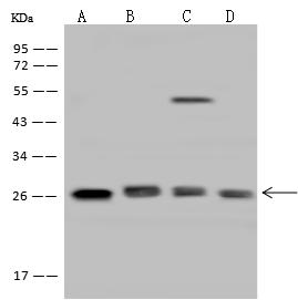ARHGDIA / RHOGDI Antibody - Immunochemical staining of human ARHGDIA in human kidney with rabbit polyclonal antibody at 1:100 dilution, formalin-fixed paraffin embedded sections.