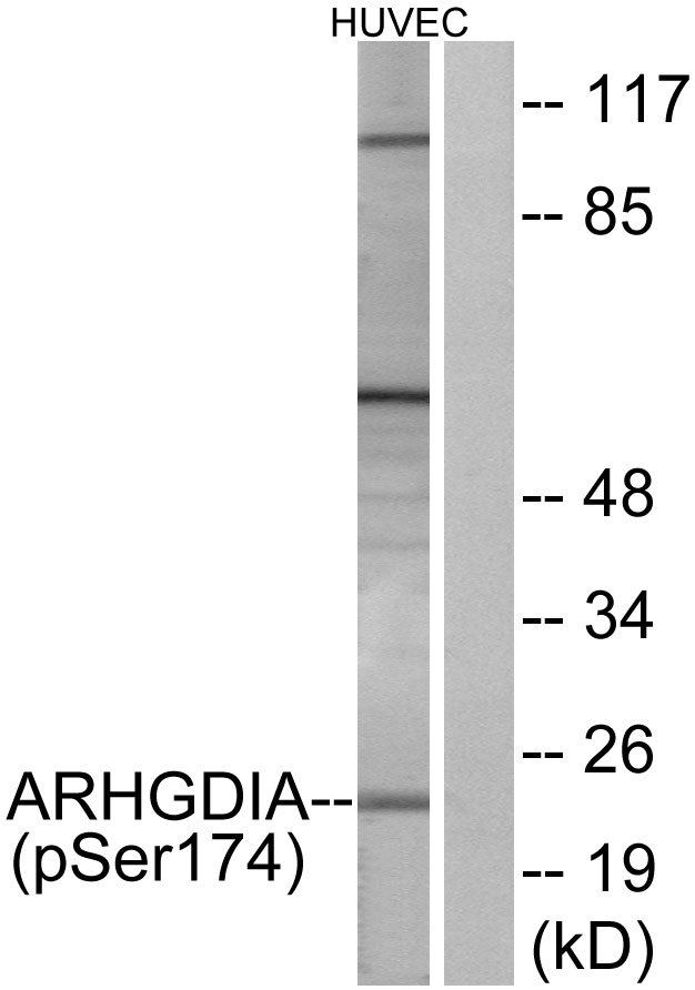 ARHGDIA / RHOGDI Antibody - Western blot analysis of lysates from HUVEC cells treated with EGF 200ng/ml 30', using ARHGDIA (Phospho-Ser174) Antibody. The lane on the right is blocked with the phospho peptide.