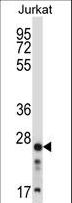 ARHGDIB / D4 GDI Antibody - ARHGDIB Antibody western blot of Jurkat cell line lysates (35 ug/lane). The ARHGDIB antibody detected the ARHGDIB protein (arrow).