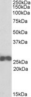 ARHGDIB / D4 GDI Antibody - ARHGDIB antibody (0.1 ug/ml) staining of Jurkat lysate (35 ug protein/ml in RIPA buffer). Primary incubation was 1 hour. Detected by chemiluminescence.
