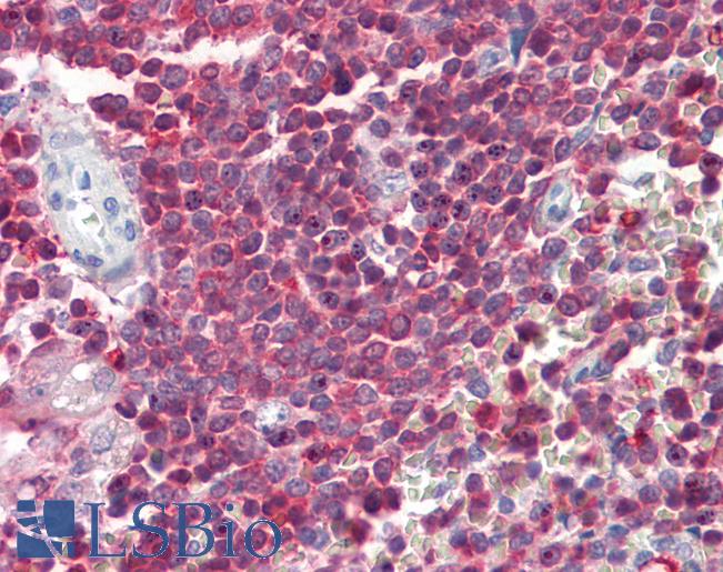 ARHGDIB / D4 GDI Antibody - Human Spleen: Formalin-Fixed, Paraffin-Embedded (FFPE)