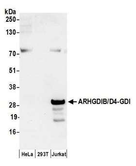 ARHGDIB / D4 GDI Antibody - Detection of human ARHGDIB/D4-GDI by western blot. Samples: Whole cell lysate (50 µg) from HeLa, HEK293T, and Jurkat cells prepared using NETN lysis buffer. Antibody: Affinity purified rabbit anti-ARHGDIB/D4-GDI antibody used for WB at 0.1 µg/ml. Detection: Chemiluminescence with an exposure time of 10 seconds.