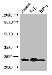 ARHGDIB / D4 GDI Antibody - Positive WB detected in:Jurkat whole cell lysate,Raji whole cell lysate,THP-1 whole cell lysate;All lanes: ARHGDIB antibody at 3ug/ml;Secondary;Goat polyclonal to rabbit IgG at 1/50000 dilution;Predicted band size: 23 kDa;Observed band size: 23 kDa;