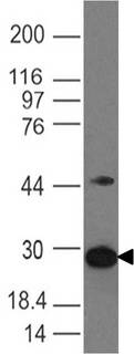 ARHGDIB / D4 GDI Antibody - Fig-1: Western blot analysis of D4-GDI. Anti-D4-GDI antibody was used at 2 µg/ml on Ramos lysate.