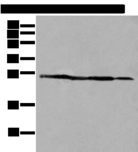 ARHGDIB / D4 GDI Antibody - Western blot analysis of 293T A431 and HepG2 cell lysates  using ARHGDIB Polyclonal Antibody at dilution of 1:500