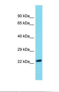 ARHGDIB / D4 GDI Antibody - Western blot of Human 721_B. ARHGDIB antibody dilution 1.0 ug/ml.  This image was taken for the unconjugated form of this product. Other forms have not been tested.