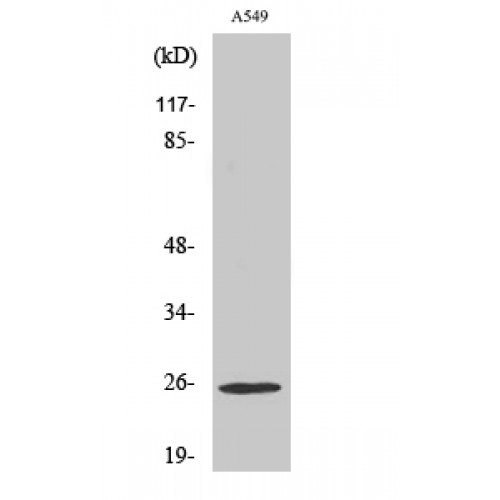 ARHGDIG / RHOGDI-3 Antibody - Western blot of Rho GDI gamma antibody