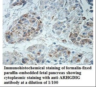 ARHGDIG / RHOGDI-3 Antibody