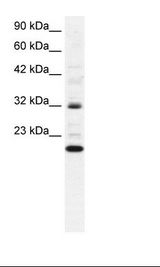 ARHGDIG / RHOGDI-3 Antibody - Daudi Cell Lysate.  This image was taken for the unconjugated form of this product. Other forms have not been tested.