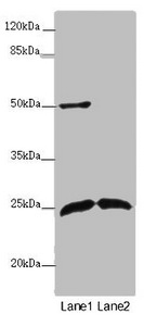 ARHGDIG / RHOGDI-3 Antibody - Western blot All Lanes :ARHGDIG antibody at 2 ug/ml Lane 1 : Mouse brain tissue Lane 2 : Mouse lung tissue Secondary Goat polyclonal to rabbit IgG at 1/10000 dilution Predicted band size: 25 kDa Observed band size: 25,50 kDa