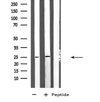 ARHGDIG / RHOGDI-3 Antibody - Western blot analysis of extracts of A549/Jurkat cells using ARHGDIG antibody.