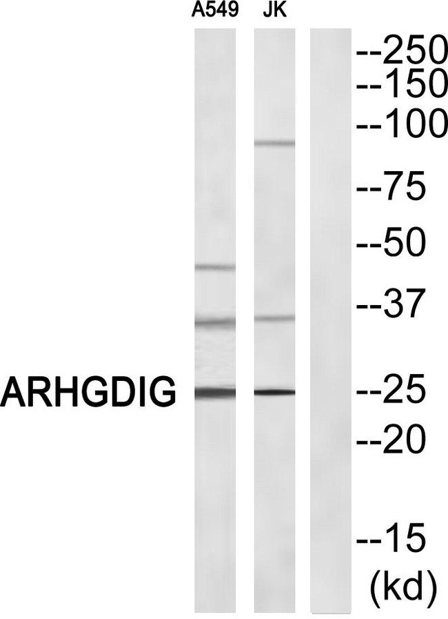 ARHGDIG / RHOGDI-3 Antibody - Western blot analysis of extracts from A549/Jurkat cells, using ARHGDIG antibody.