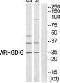 ARHGDIG / RHOGDI-3 Antibody - Western blot analysis of extracts from A549/Jurkat cells, using ARHGDIG antibody.