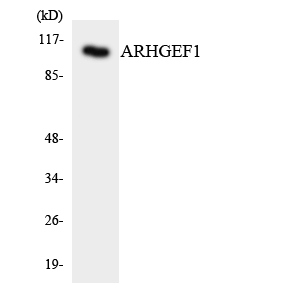 ARHGEF1 Antibody - Western blot analysis of the lysates from HepG2 cells using ARHGEF1 antibody.
