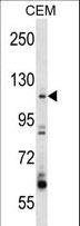 ARHGEF1 Antibody - ARHGEF1 Antibody western blot of CEM cell line lysates (35 ug/lane). The ARHGEF1 antibody detected the ARHGEF1 protein (arrow).