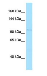ARHGEF1 Antibody - ARHGEF1 antibody Western Blot of Jurkat.  This image was taken for the unconjugated form of this product. Other forms have not been tested.
